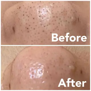 beauty salonnのエステ・リラクイメージ