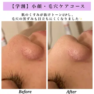 Bellesthe (ベルエステ)のエステ・リラクイメージ