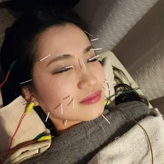 むくみたるみ専門☆ 美容鍼・小顔矯正のエステ・リラクイメージ