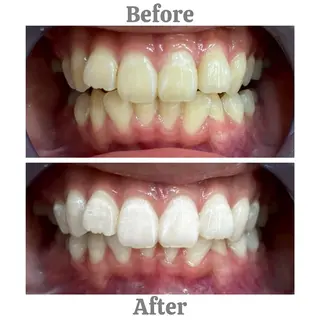 セルフホワイトニング　エクシア相模大野店所属・セルフホワイトニング エクシア相模大野店のその他イメージ