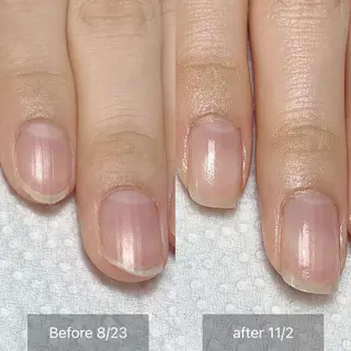 ネイル 木村 千晴のネイルデザイン