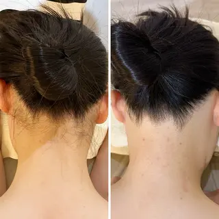 うなじ脱毛/美肌脱毛 LABELのエステ・リラクイメージ