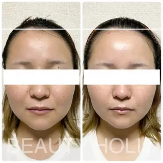 ニキビ・ 肌荒れ専門店のエステ・リラクイメージ