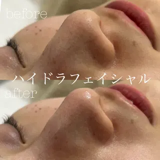 フェイシャルサロン CHIARA 荒田のエステ・リラクイメージ