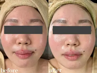 WHITE AQUA 北千住店のエステ・リラクイメージ