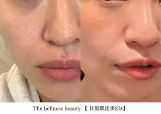 《毛穴レス美肌》ザ・ ベルネス 目黒駅2分のエステ・リラクイメージ