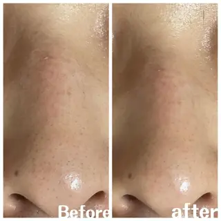 肌質改善サロン facialmoonのエステ・リラクイメージ