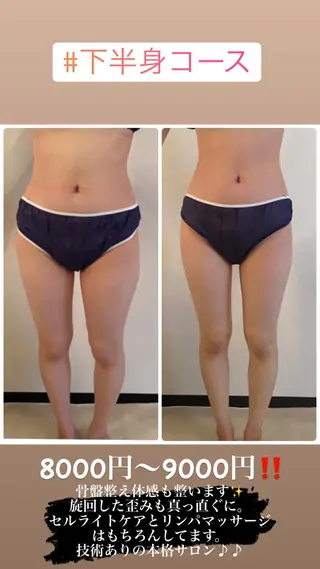 FLEUR大阪・整体 ・ハイフ・痩身・小顔のエステ・リラクイメージ