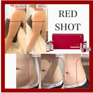 フェイシャル/脱毛 ジョアアンジェ　田中のエステ・リラクイメージ