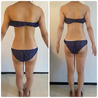 FLEUR大阪・整体 ・ハイフ・痩身・小顔のエステ・リラクイメージ