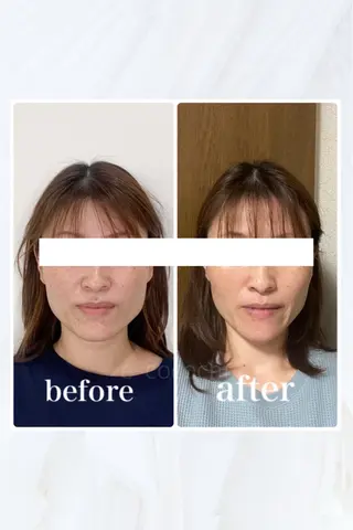 小顔と ヘッドスパのお店のエステ・リラクイメージ