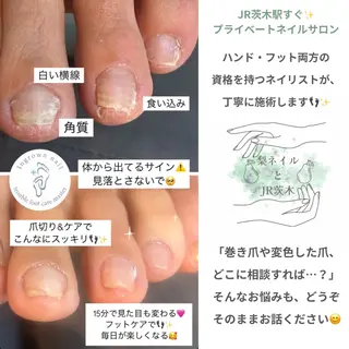 ネイル 梨ネイルとJR茨木所属・井上 愛梨のネイルデザイン