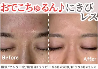 sii センター北 AIのエステ・リラクイメージ