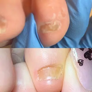 ネイル Cure.美爪育成 salon 岡澤のネイルデザイン