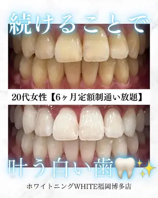 キッズ メンズ ホワイトニングサロン WHITE福岡博多店のエステ・リラクイメージ