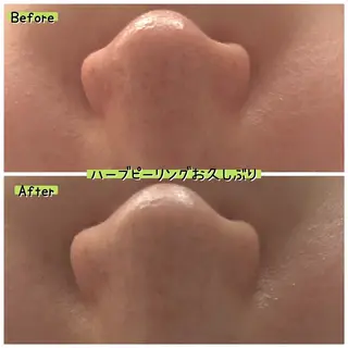 ぱんだ王国エステ所属・ぱんだ王国 エステのエステ・リラクイメージ