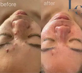 Le cherienのエステ・リラクイメージ