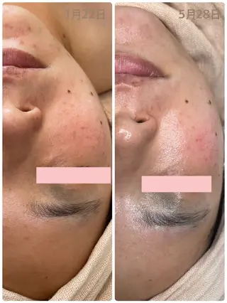 mihan beauteのエステ・リラクイメージ