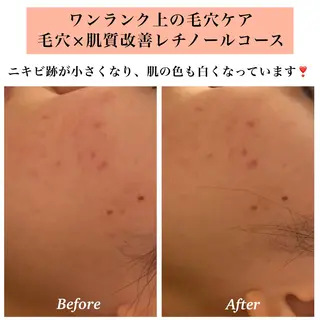 Bellesthe (ベルエステ)のエステ・リラクイメージ