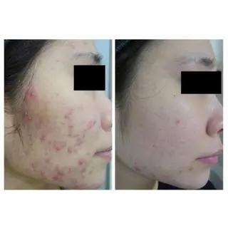 肌質改善専門サロン 川島 彩のエステ・リラクイメージ