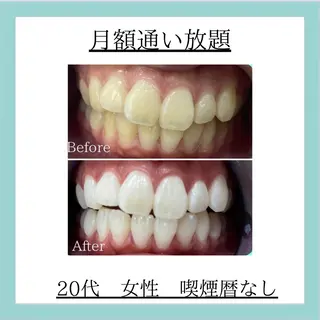 ホワイトニング専門店 WHITE天神店のエステ・リラクイメージ