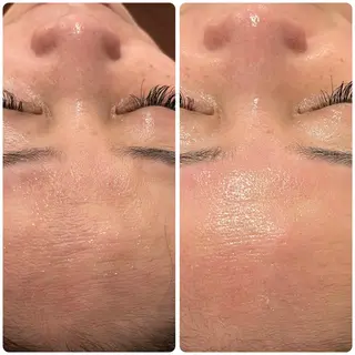 立体小顔×艶肌×美ボ ディ似合わせ施術 岡のエステ・リラクイメージ