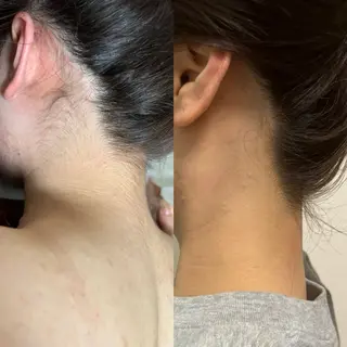 透明感の肌Lino malieのエステ・リラクイメージ