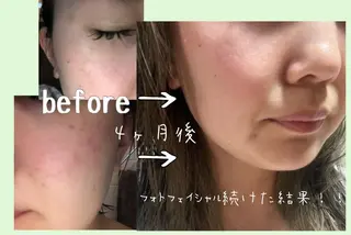 美肌脱毛と癒しのプライベートサロン。gratia~グレイティア~所属・gratia ~グレイティア~のエステ・リラクイメージ