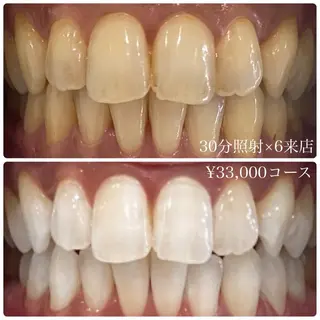 PLATINUM Beauty 横浜店所属・ホワイトニングルーム 横浜店のその他イメージ