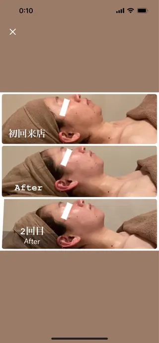 B&H所属・頭痛•肩こり専門/ 眉サロンB&H心斎橋のエステ・リラクイメージ