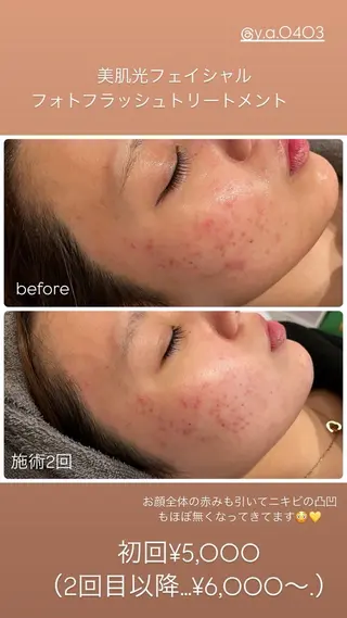 yellow.所属・yellow💛【 脱毛&フェイシャル】のエステ・リラクイメージ