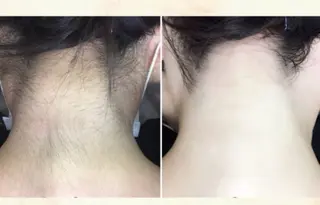 脱毛専門減毛サロン LULU.tokyoのエステ・リラクイメージ