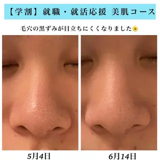 Bellesthe (ベルエステ)のエステ・リラクイメージ