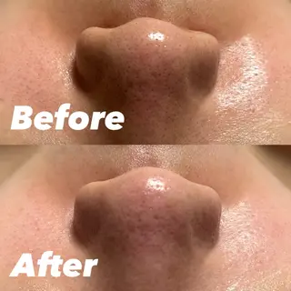 White labo 今村のエステ・リラクイメージ