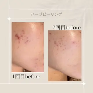 ピーリング専門店 Belluteのエステ・リラクイメージ