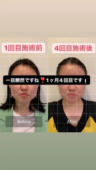 美まつ毛❤️美眉毛 🌈✨Mebereのマツエク・マツパデザイン