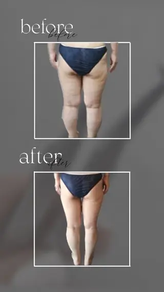 温活痩身サロン ヨサパークリリーのエステ・リラクイメージ