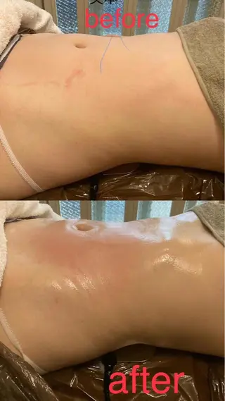 ショート リラクゼーション＆エステランベリー所属・ランベリ ランベリのエステ・リラクイメージ