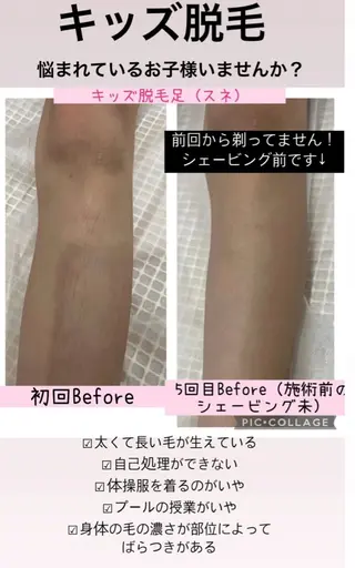 ブライダル痩身×脱毛 尼崎駅前サロンのエステ・リラクイメージ