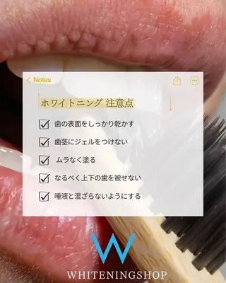 ホワイトニングショップ津店所属・ホワイトニング ショップ津店のその他イメージ