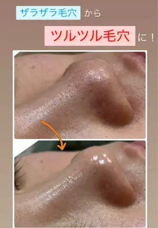 美肌脱毛専門サロン muro.のエステ・リラクイメージ