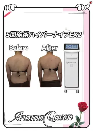 アロマクイーン所属・所沢痩身小顔コルギ AromaQueenのエステ・リラクイメージ