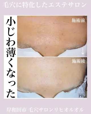 毛穴汚れ改善専門店/ 岸和田/リヒオルオルのエステ・リラクイメージ