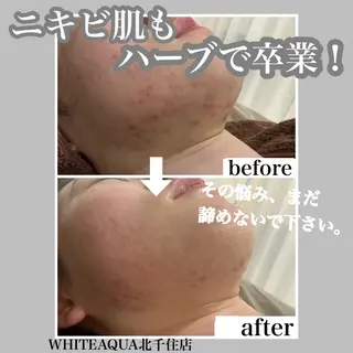 WHITE AQUA 北千住店のエステ・リラクイメージ