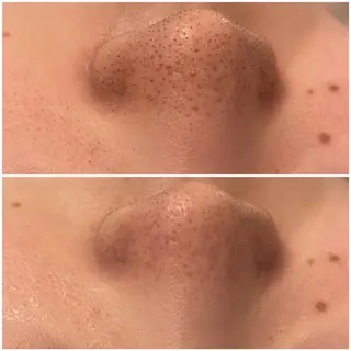 ✨美肌水光✨ アトリエリュバンのエステ・リラクイメージ