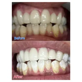 MBEAUTYSALON 千葉店・京成大久保所属・Melty 輝のその他イメージ