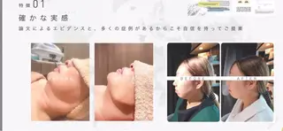 エステ.まつげ.小顔 眉毛.プラズマ.脱毛のエステ・リラクイメージ