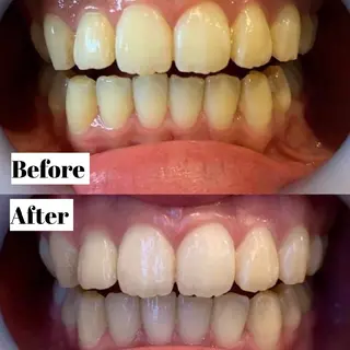 LBS吉祥寺 公式のエステ・リラクイメージ