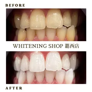 メンズ ホワイトニング ショップ葛西店のその他イメージ