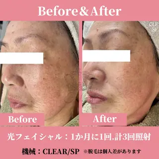 メンズ 有人型セルフサロン 脱毛/痩身/美顔のその他イメージ